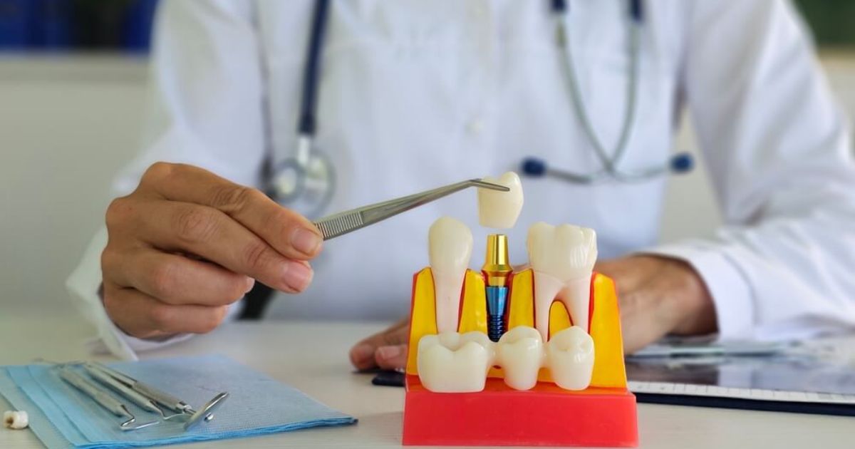 Consórcio para Implante Dentário em Natal RN